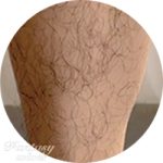 Thick leg hair