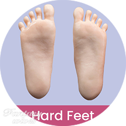Hard Feet (FREE)